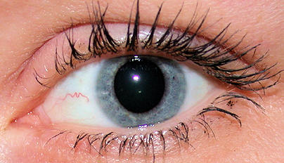 Augendiagnose Irisdiagnose