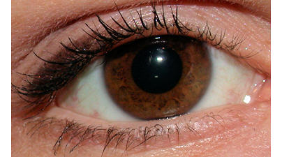 Augendiagnose Irisdiagnose